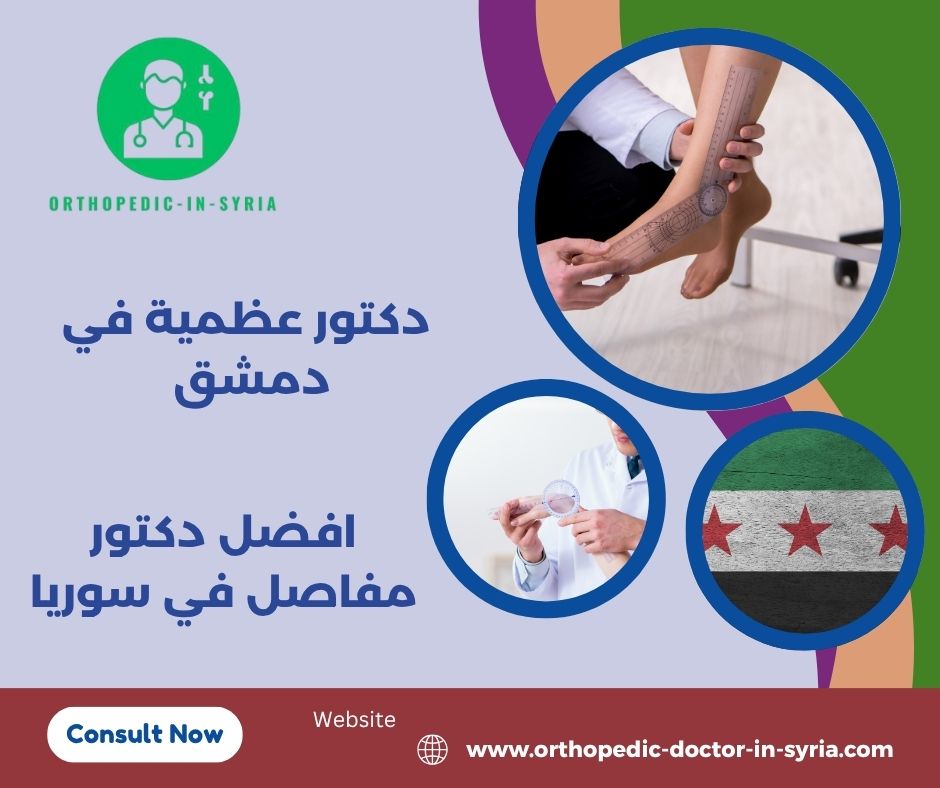 افضل دكتور مفاصل في سوريا