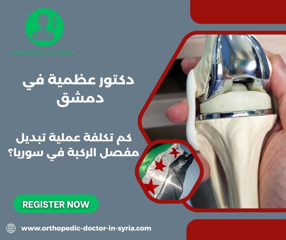 كم تكلفة عملية تبديل مفصل الركبة في سوريا؟ بالدولار؟