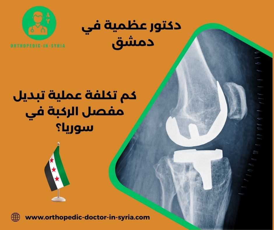 هل يوجد بديل لعملية تغيير مفصل الركبة؟