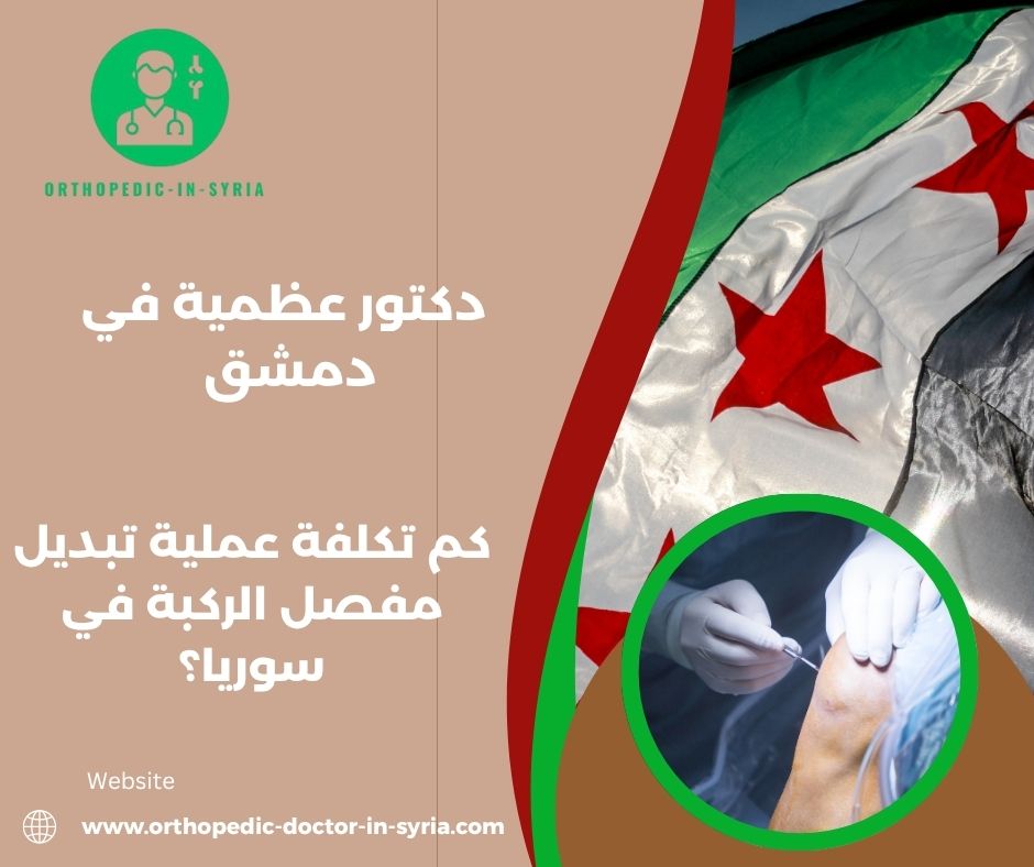 كم تكلفة عملية تبديل مفصل الركبة في سوريا؟
