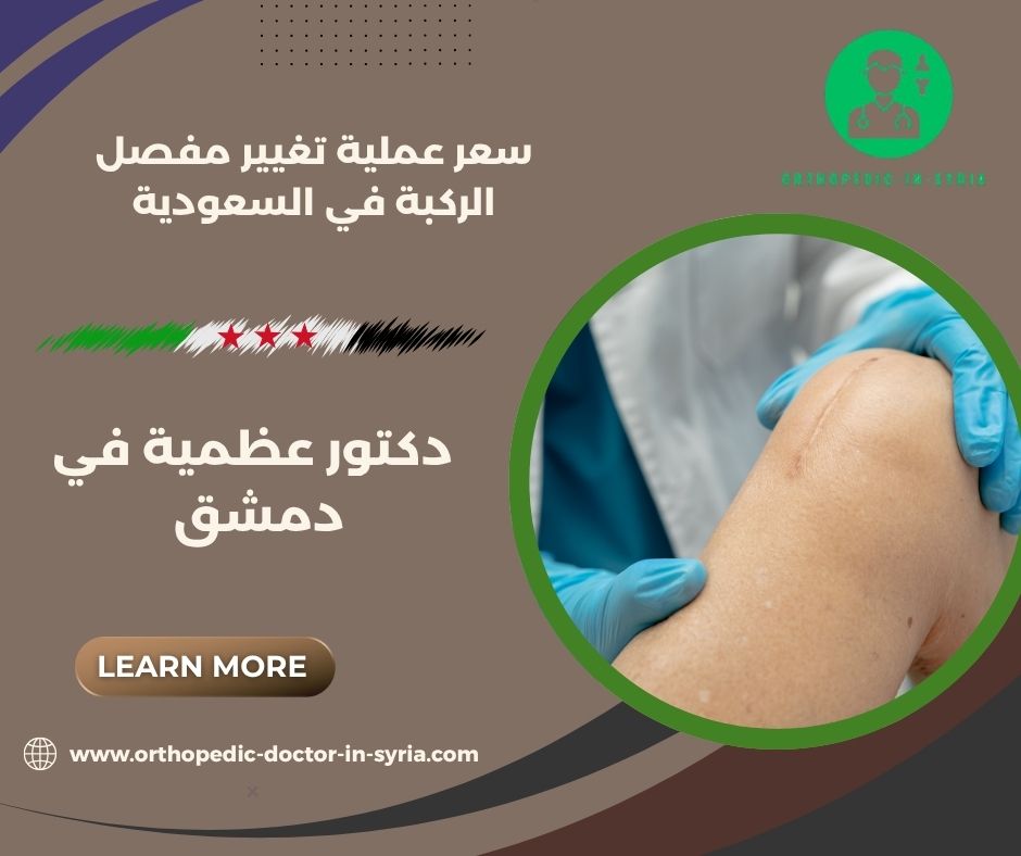 أضرار عملية تغيير مفصل الركبة