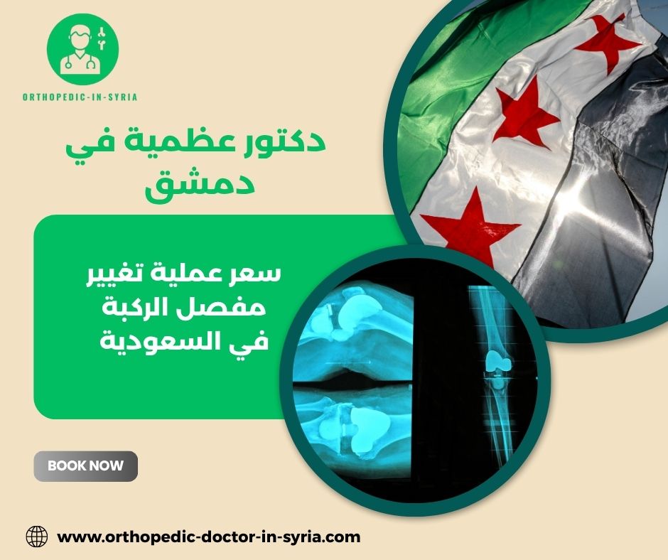 تكلفة عملية تغيير مفصل الركبة في مختلف الدول