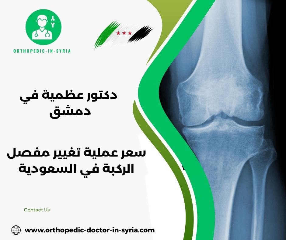 أفضل دكتور تغيير مفصل الركبة في الرياض