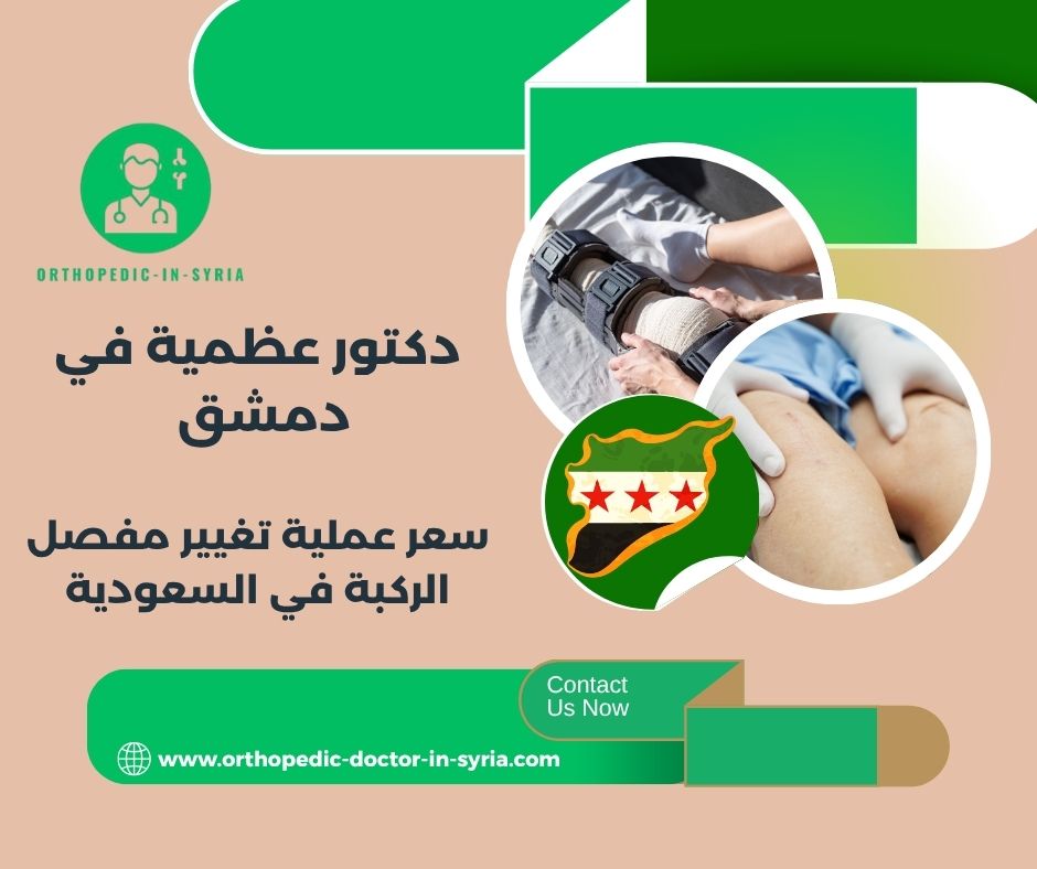 سعر عملية تغيير مفصل الركبة في السعودية