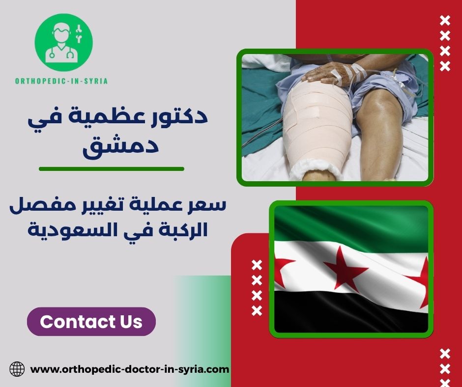 سعر عملية تغيير مفصل الركبة في الحبيب