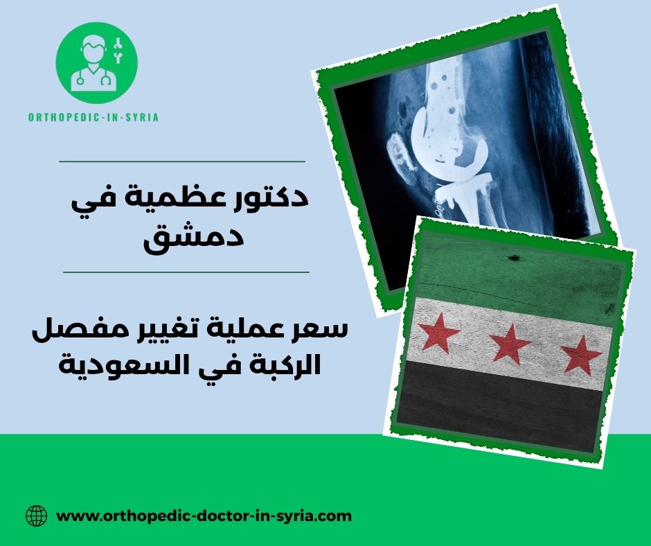 سعر عملية تغيير مفصل الركبة في السعودية