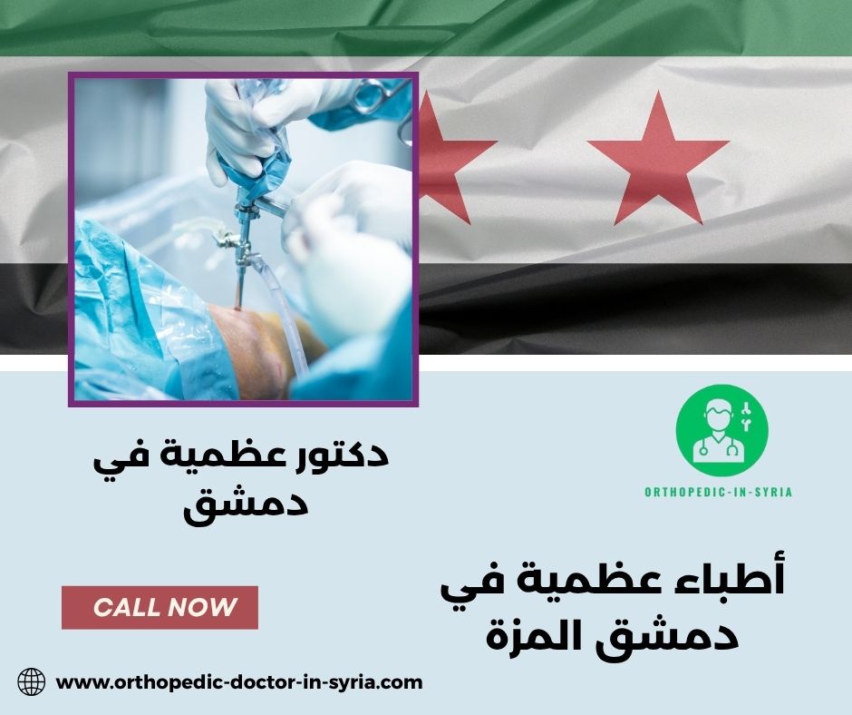 أطباء عظمية في دمشق المزة