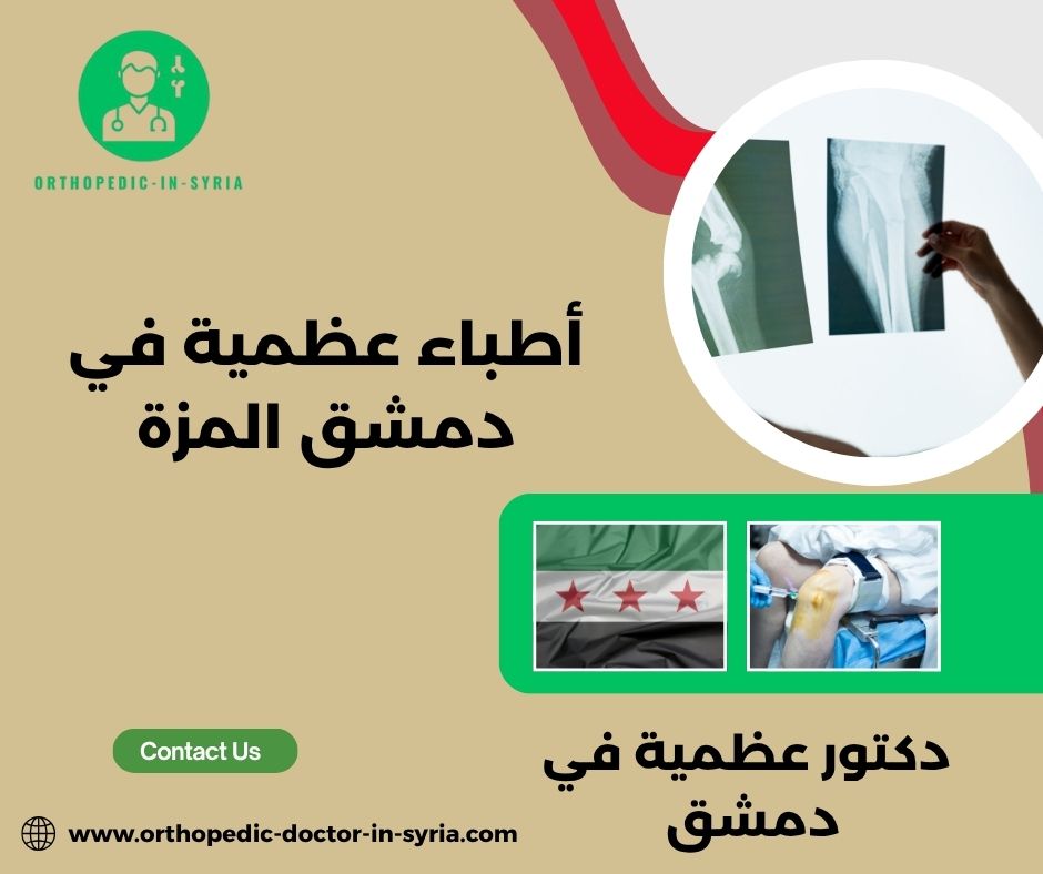 دكتور عظمية في دمشق الجسر الابيض دكتور عظمية في دمشق الجسر الابيض