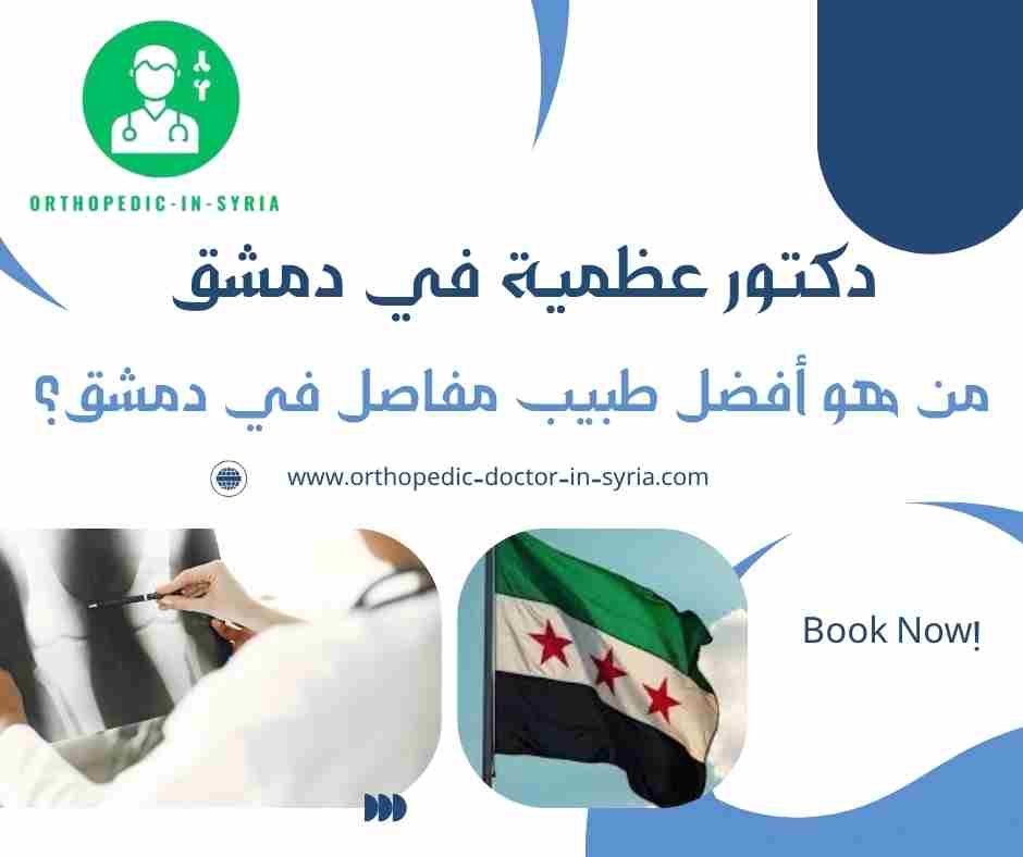من هو أفضل طبيب مفاصل في دمشق؟