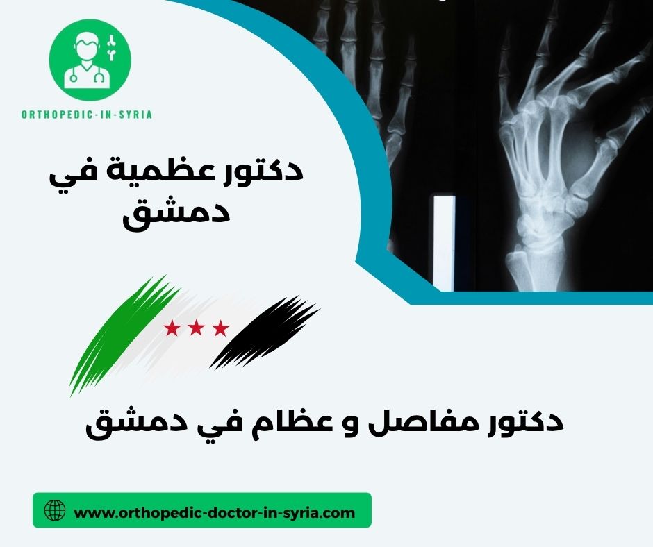 دكتور مفاصل و روماتيزم دمشق
