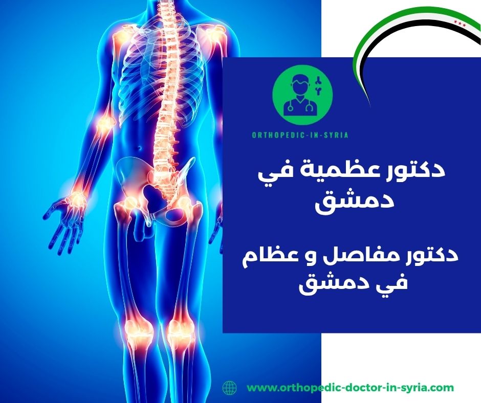 دكتور مفاصل و عظام في دمشق