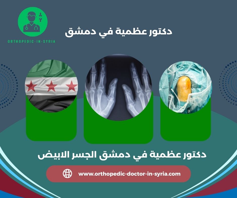 دكتور عظمية في مساكن برزة