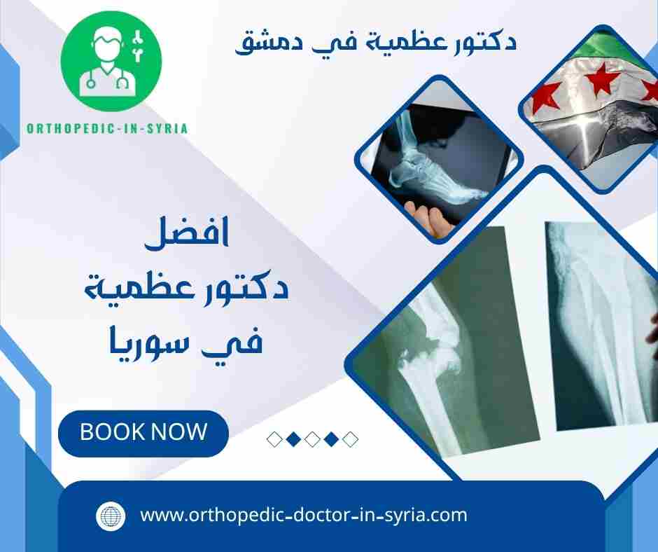 افضل دكتور عظمية في سوريا