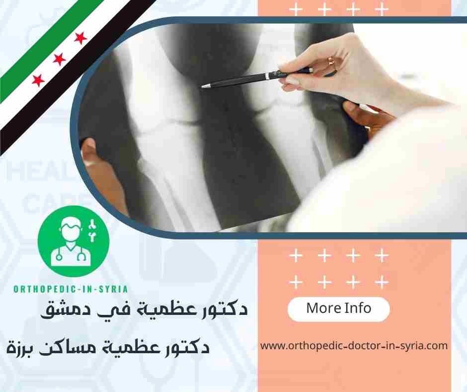 دكتور عظمية في مساكن برزة