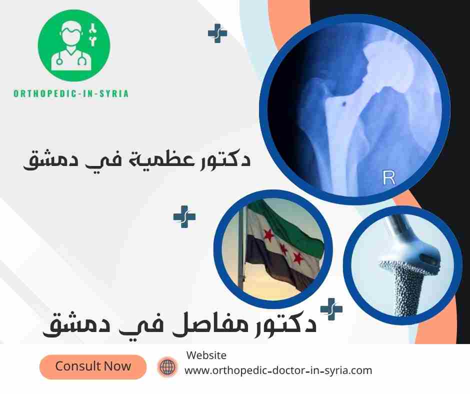 دكتور مفاصل في دمشق