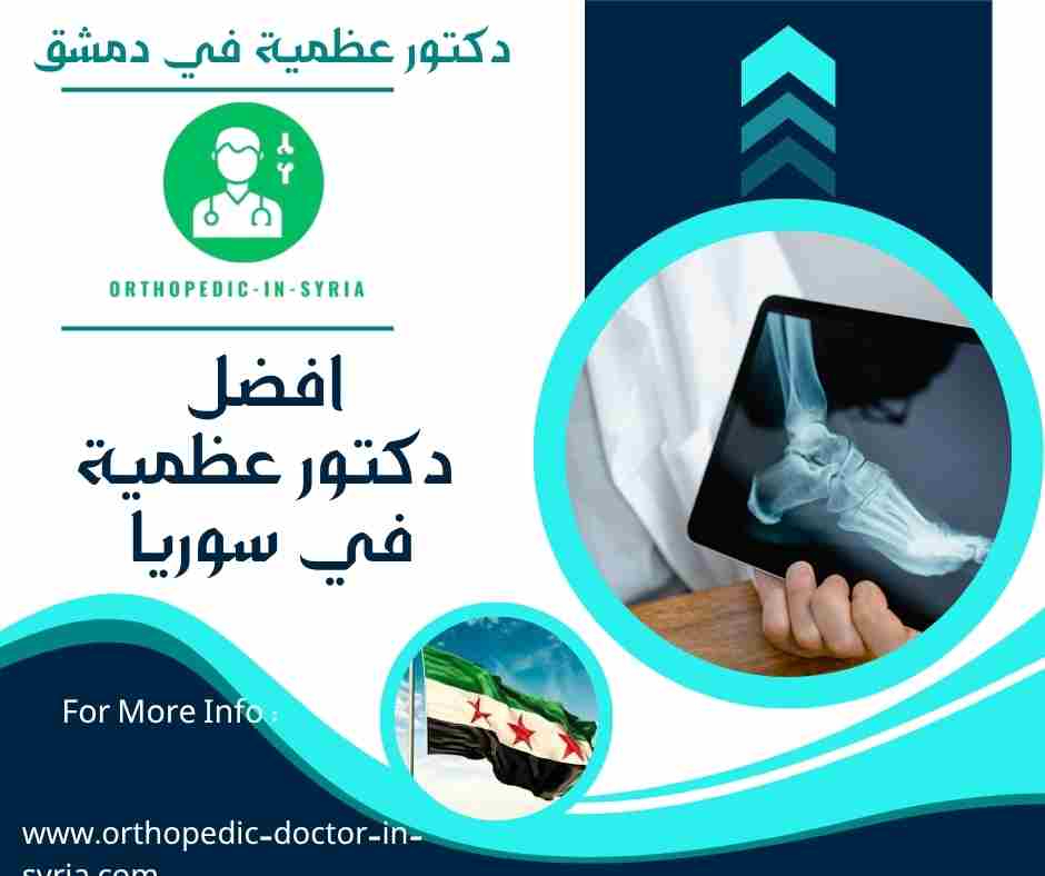 افضل دكتور عظمية في سوريا