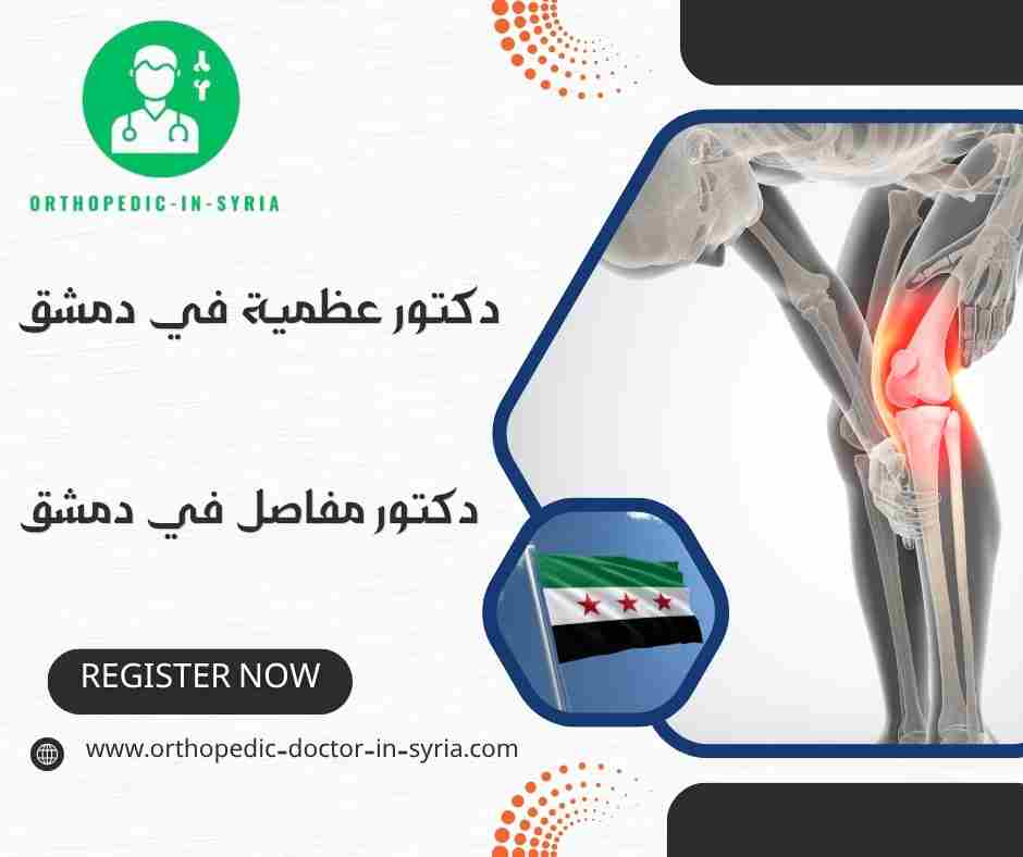 دكتور مفاصل في دمشق