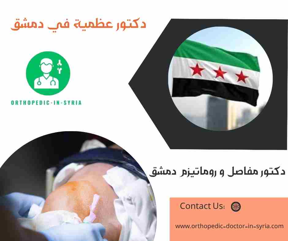 دكتور مفاصل و روماتيزم دمشق