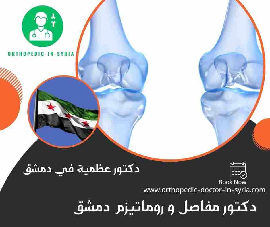دكتور مفاصل و روماتيزم دمشق