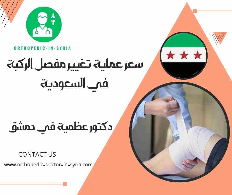 سعر عملية تغيير مفصل الركبة في السعودية