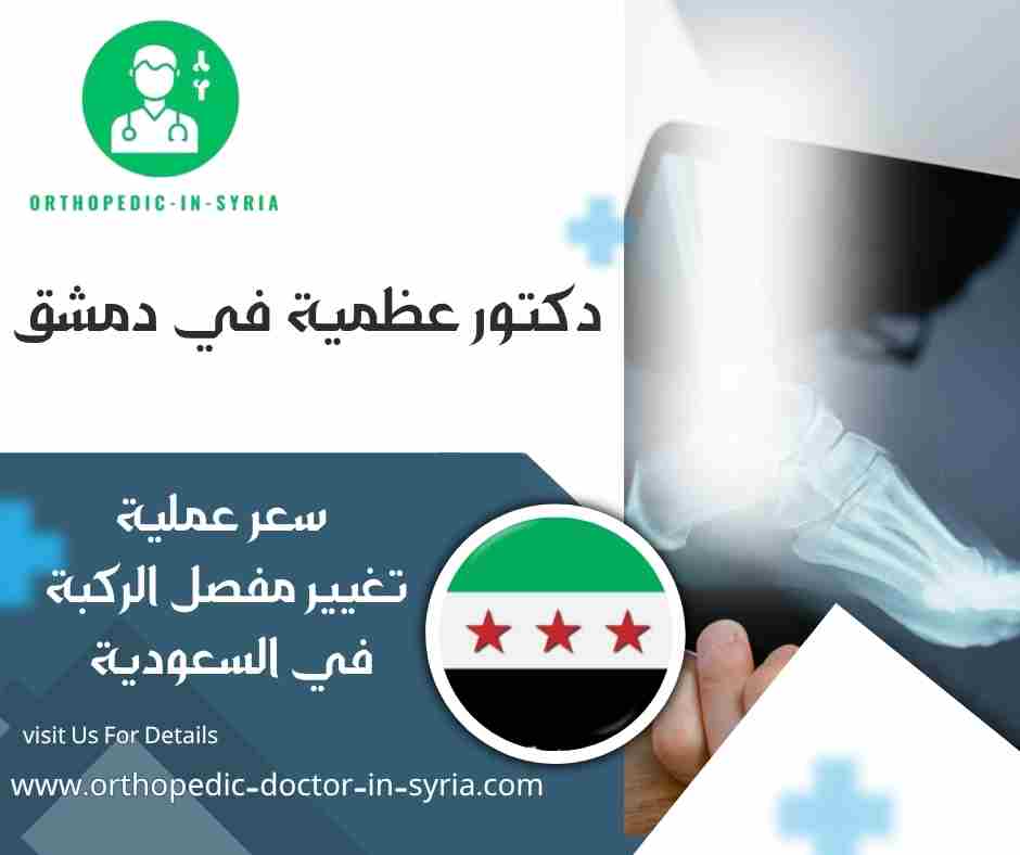 سعر عملية تغيير مفصل الركبة في السعودية