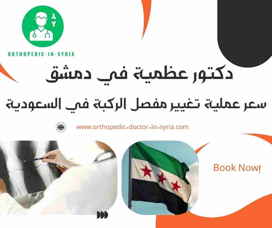 سعر عملية تغيير مفصل الركبة في السعودية