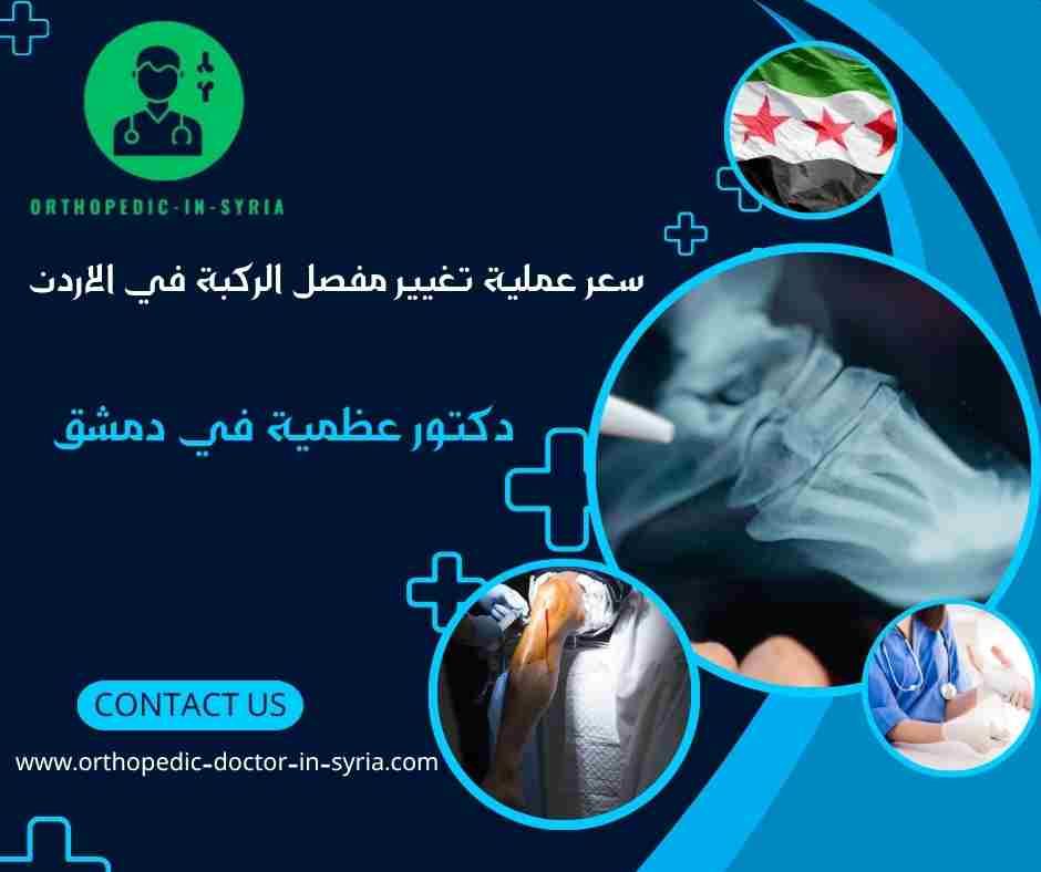 سعر عملية تغيير مفصل الركبة في الاردن