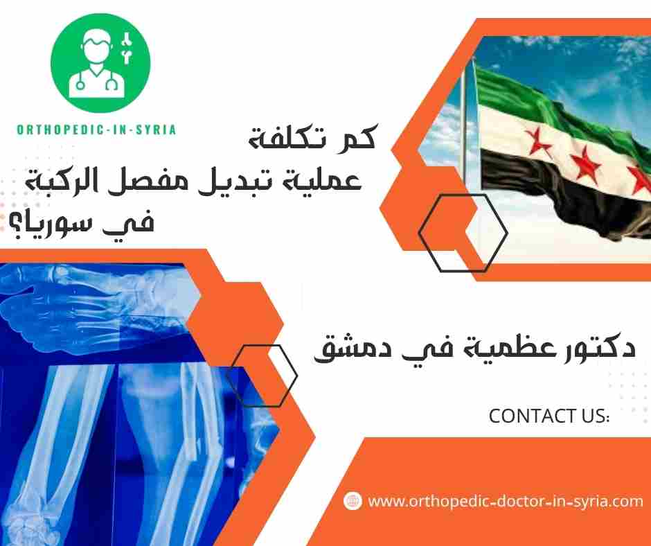 كم تكلفة عملية تبديل مفصل الركبة في سوريا؟