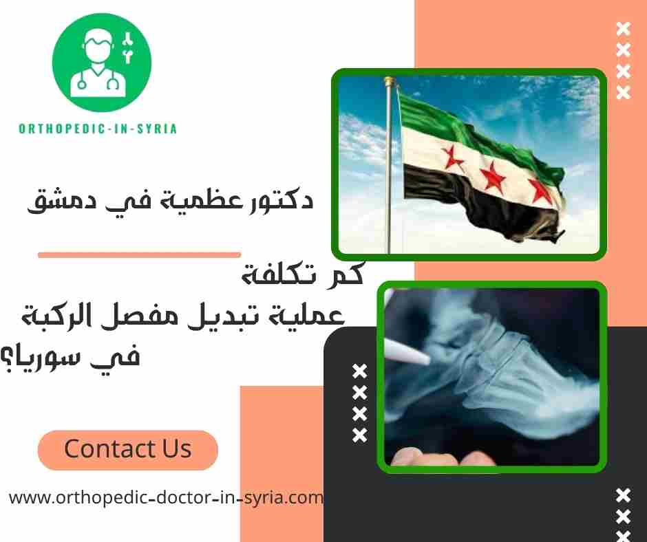 كم تكلفة عملية تبديل مفصل الركبة في سوريا؟