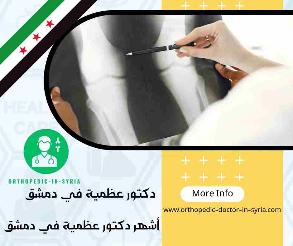 أشهر دكتور عظمية في دمشق