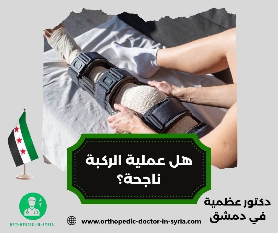 كم يستمر الألم بعد تغيير مفصل الركبة؟