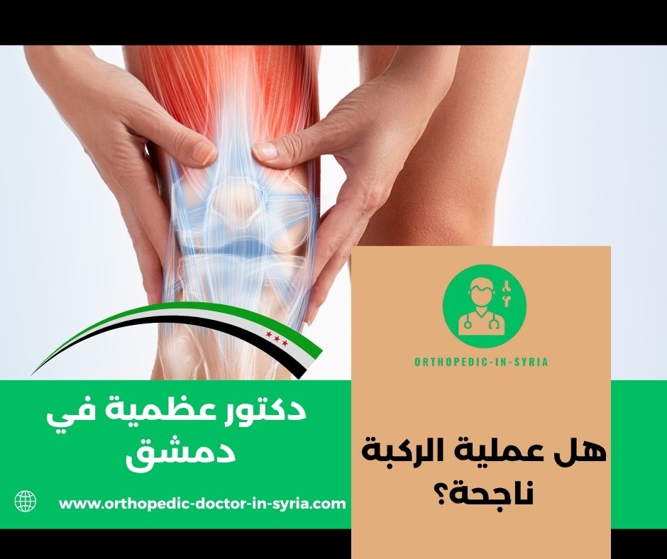 هل يوجد بديل لعملية تغيير مفصل الركبة؟