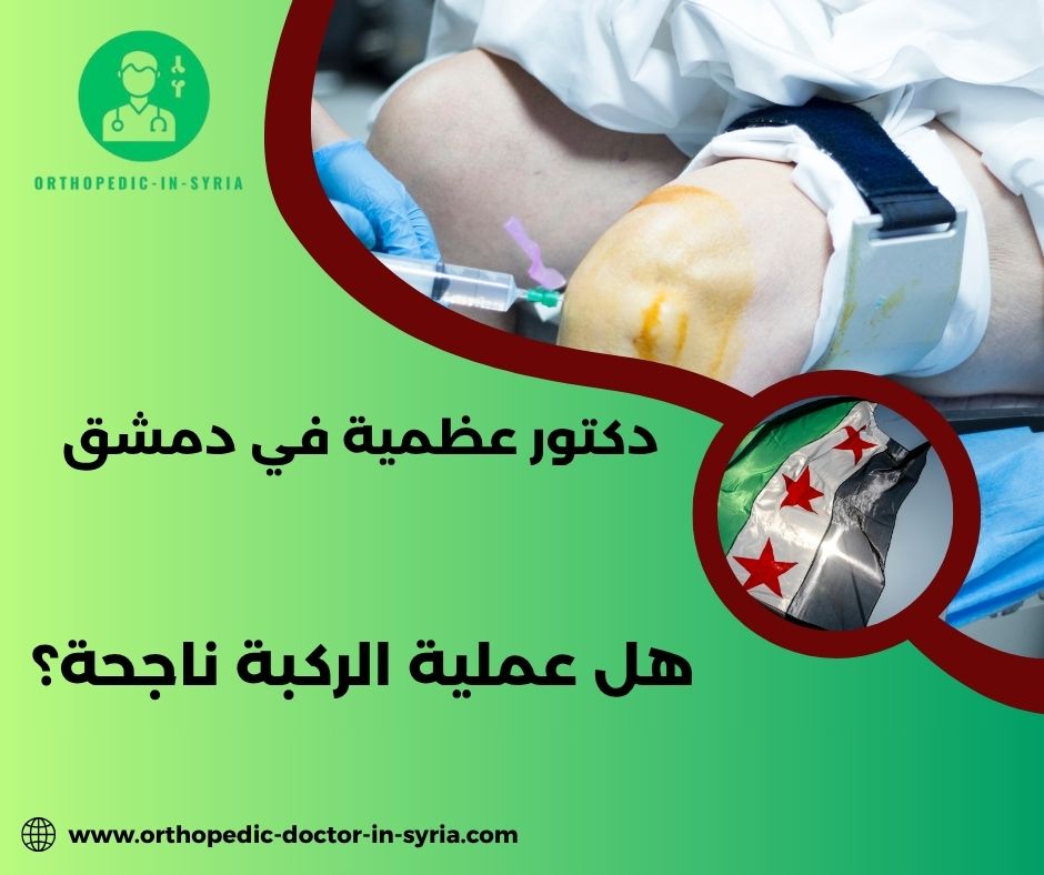 آراء بعض المرضى حول الاستفسار :هل عملية الركبة ناجحة؟