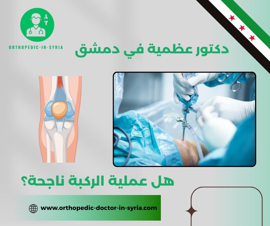 هل عملية الركبة ناجحة؟