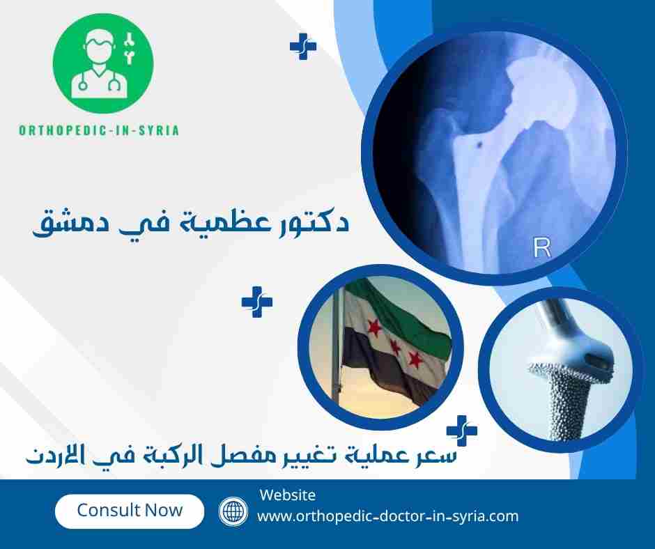 سعر عملية تغيير مفصل الركبة في الاردن