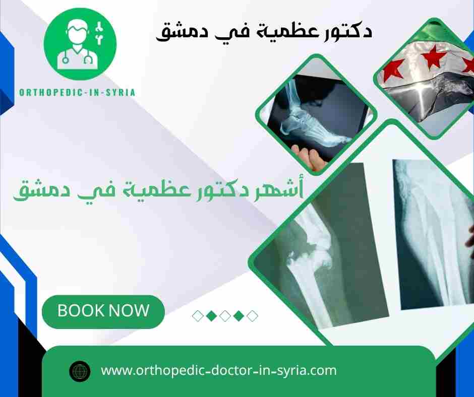 أشهر دكتور عظمية في دمشق