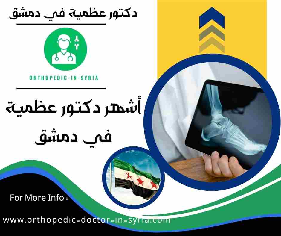 أشهر دكتور عظمية في دمشق