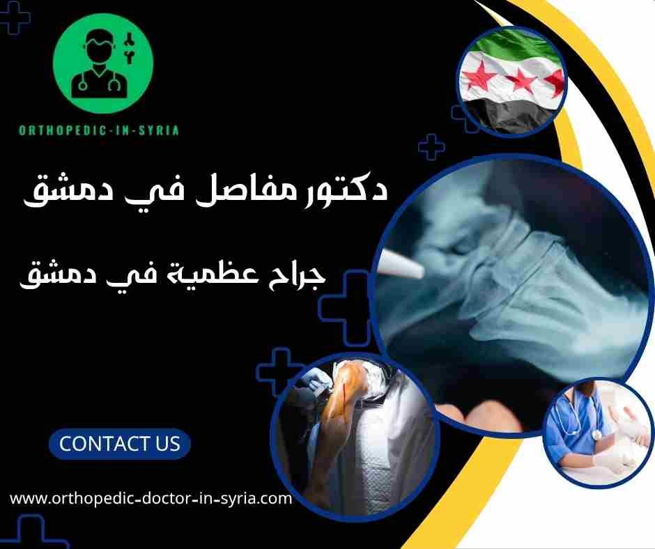 جراح عظمية في دمشق