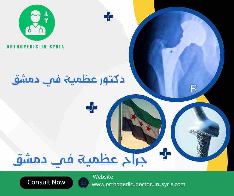 جراح عظمية في دمشق