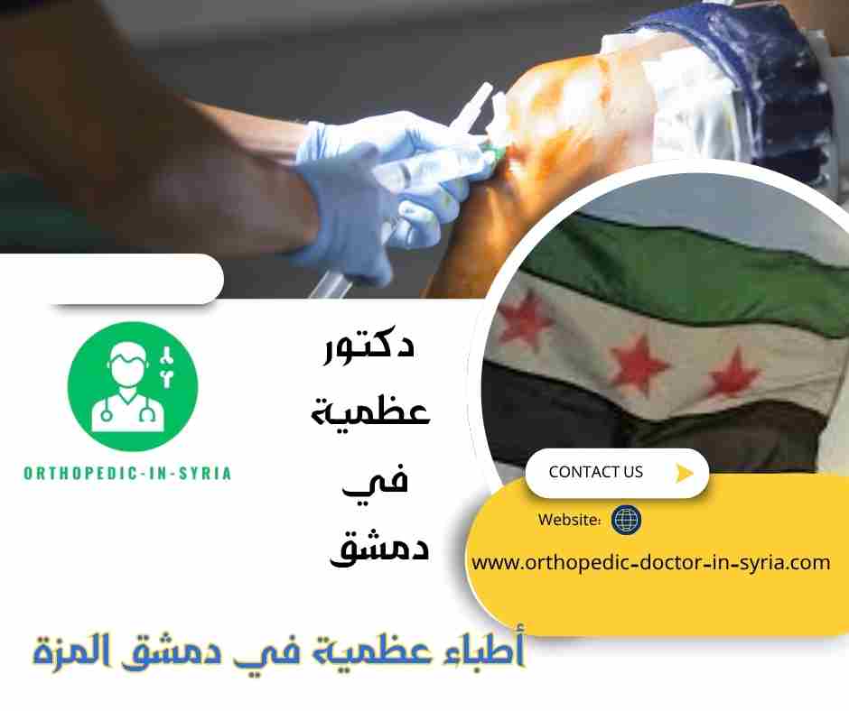 أطباء عظمية في دمشق المزة