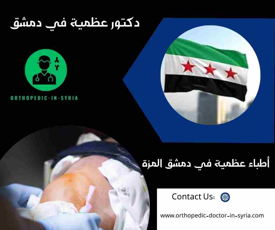 أطباء عظمية في دمشق المزة