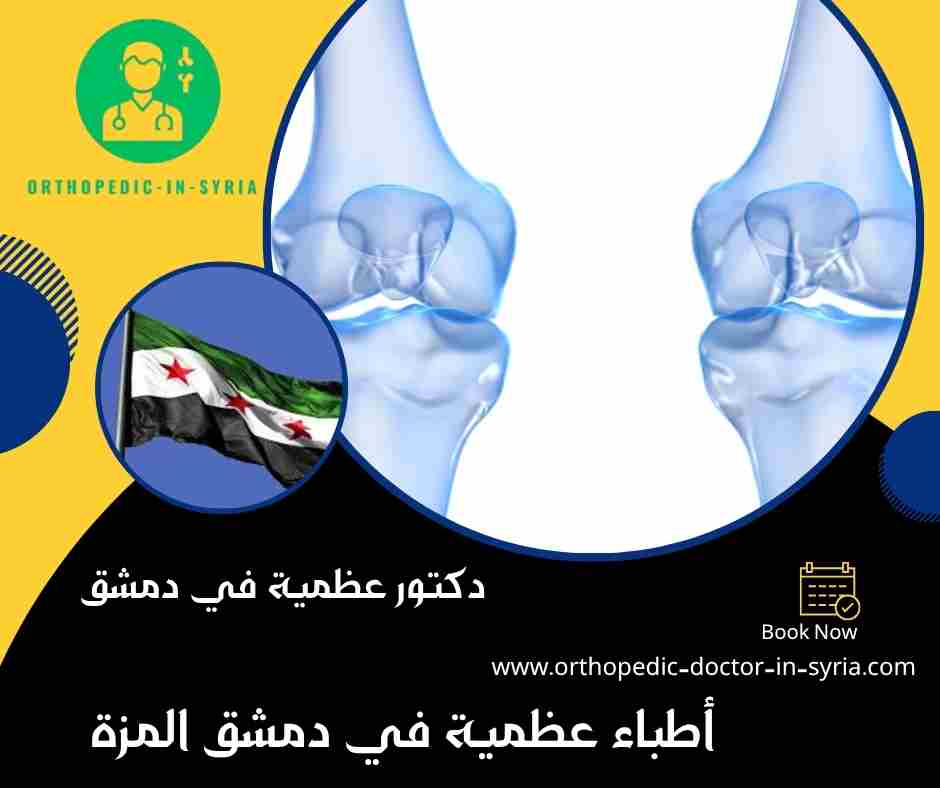 أطباء عظمية في دمشق المزة