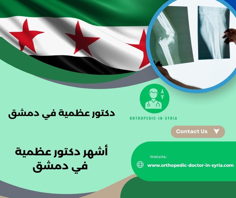 أشهر دكتور عظمية في دمشق