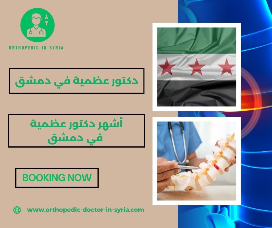 أشهر دكتور عظمية في دمشق