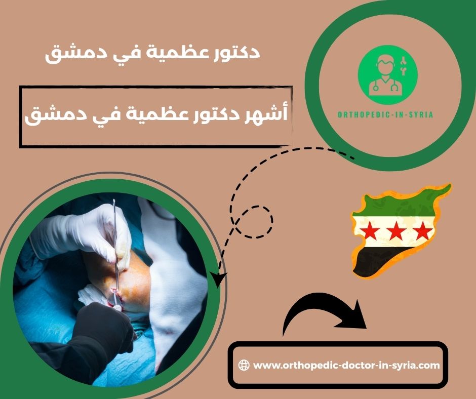 دكتور مفاصل وعظام في دمشق