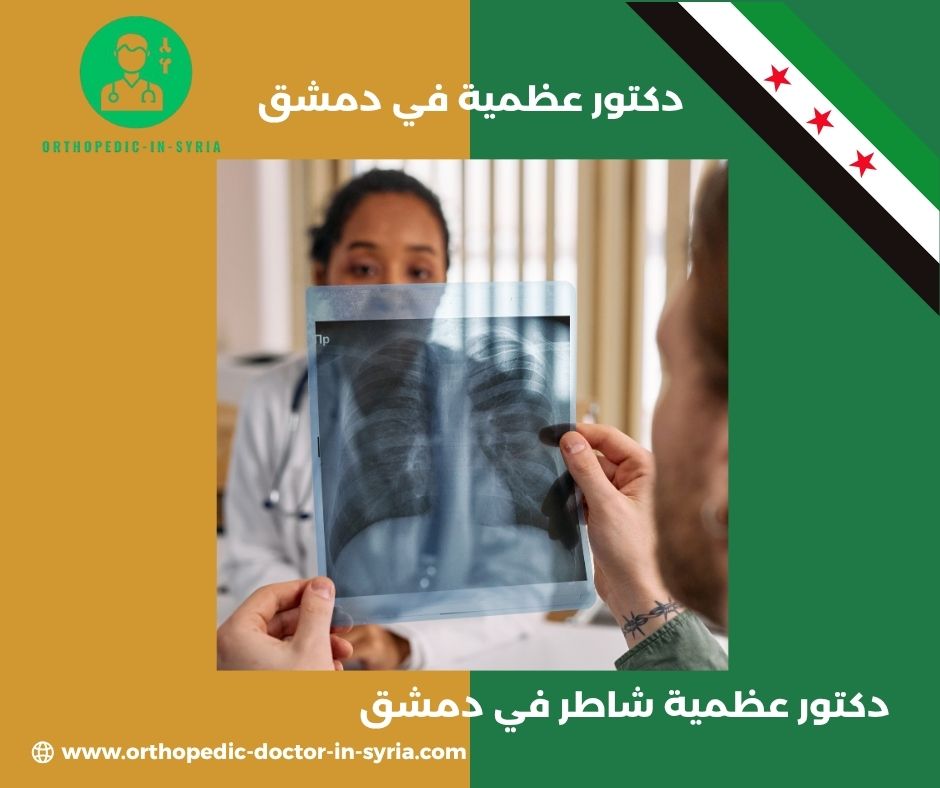 دكتور مفاصل و عظام في دمشق