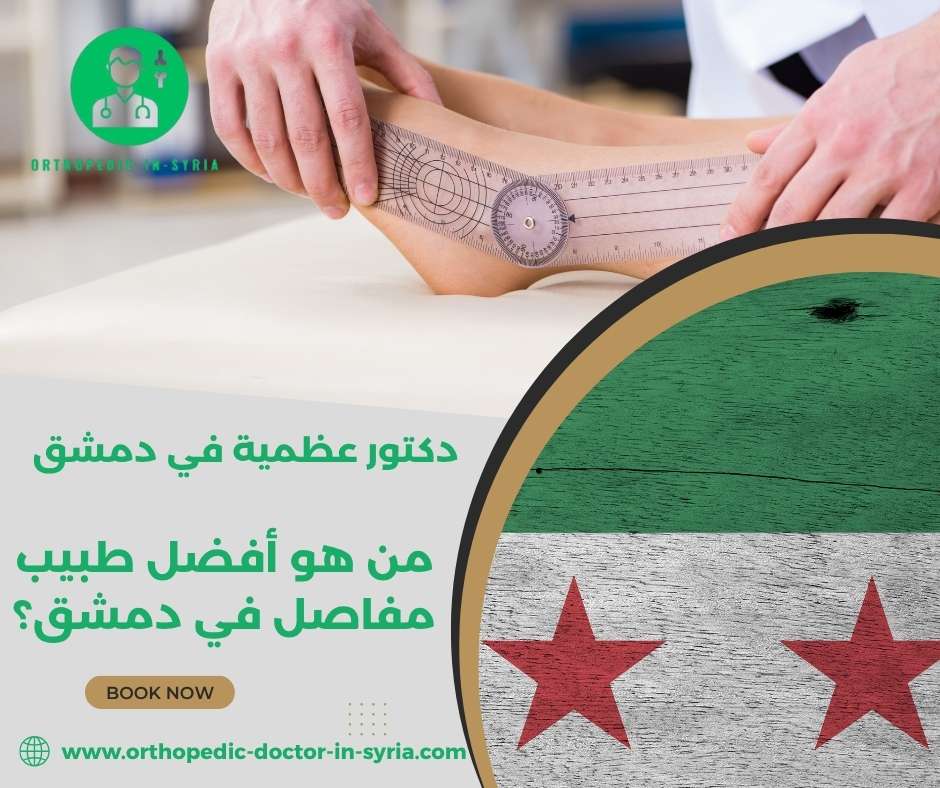 من هو أفضل طبيب مفاصل في دمشق؟