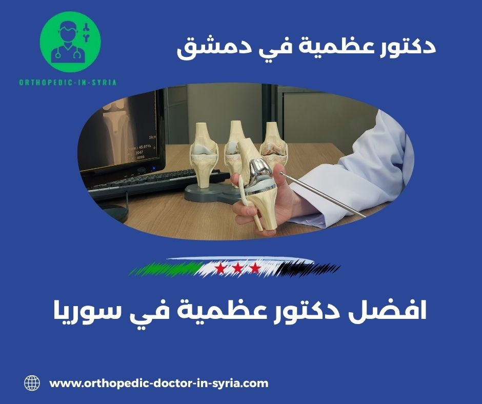 أشهر دكتور عظمية في دمشق