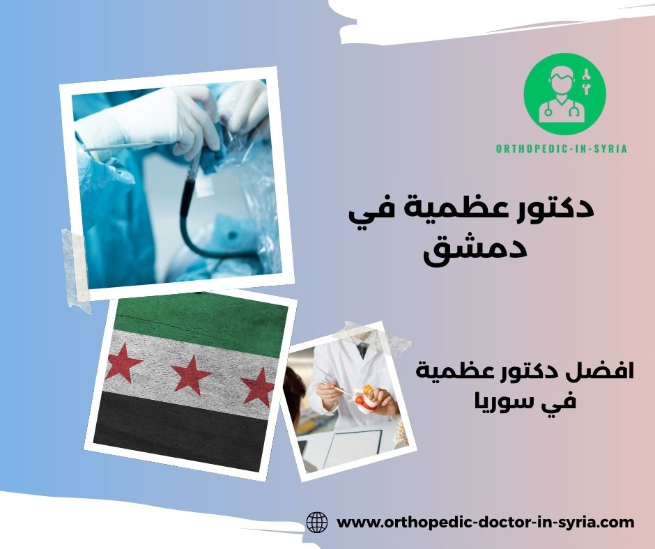 افضل دكتور عظمية في سوريا