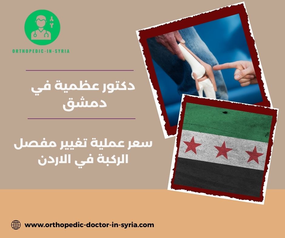 سعر عملية تغيير مفصل الركبة في الاردن سعر عملية تغيير مفصل الركبة في الاردن